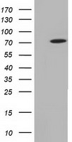 MTMR14 Antibody - HEK293T cells were transfected with the pCMV6-ENTRY control (Left lane) or pCMV6-ENTRY MTMR14 (Right lane) cDNA for 48 hrs and lysed. Equivalent amounts of cell lysates (5 ug per lane) were separated by SDS-PAGE and immunoblotted with anti-MTMR14.