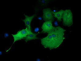 MTMR14 Antibody - Anti-MTMR14 mouse monoclonal antibody  immunofluorescent staining of COS7 cells transiently transfected by pCMV6-ENTRY MTMR14.