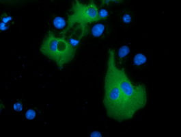 MTMR14 Antibody - Anti-MTMR14 mouse monoclonal antibody  immunofluorescent staining of COS7 cells transiently transfected by pCMV6-ENTRY MTMR14.