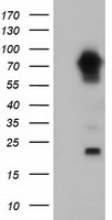 MTMR14 Antibody - HEK293T cells were transfected with the pCMV6-ENTRY control (Left lane) or pCMV6-ENTRY MTMR14 (Right lane) cDNA for 48 hrs and lysed. Equivalent amounts of cell lysates (5 ug per lane) were separated by SDS-PAGE and immunoblotted with anti-MTMR14.