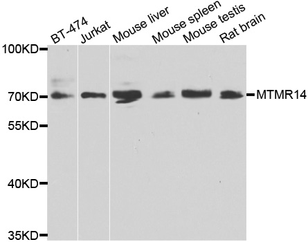 MTMR14 Antibody - Western blot analysis of extracts of various cell lines.