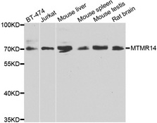 MTMR14 Antibody - Western blot analysis of extracts of various cell lines.