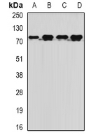 MTMR14 Antibody - Western blot analysis of MTMR14 expression in BT474 (A); Jurkat (B); mouse liver (C); rat brain (D) whole cell lysates.