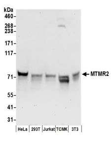 MTMR2 Antibody - Detection of human and mouse MTMR2 by western blot. Samples: Whole cell lysate (50 µg) from HeLa, HEK293T, Jurkat, mouse TCMK-1, and mouse NIH 3T3 cells prepared using NETN lysis buffer. Antibodies: Affinity purified rabbit anti-MTMR2 antibody used for WB at 0.4 µg/ml. Detection: Chemiluminescence with an exposure time of 30 seconds.