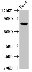 MTMR2 Antibody - Positive Western Blot detected in Hela whole cell lysate. All lanes: MTMR2 antibody at 5.5 µg/ml Secondary Goat polyclonal to rabbit IgG at 1/50000 dilution. Predicted band size: 74, 66 KDa. Observed band size: 74 KDa