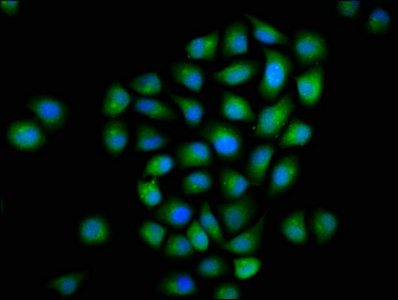 MTMR2 Antibody - Immunofluorescence staining of Hela cells with MTMR2 Antibody at 1:133, counter-stained with DAPI. The cells were fixed in 4% formaldehyde, permeabilized using 0.2% Triton X-100 and blocked in 10% normal Goat Serum. The cells were then incubated with the antibody overnight at 4°C. The secondary antibody was Alexa Fluor 488-congugated AffiniPure Goat Anti-Rabbit IgG(H+L).