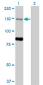 MTMR3 Antibody - Western blot of MTMR3 expression in transfected 293T cell line by MTMR3 monoclonal antibody (M07), clone 1E11.
