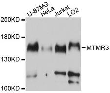 MTMR3 Antibody - Western blot analysis of extracts of various cell lines, using MTMR3 antibody at 1:1000 dilution. The secondary antibody used was an HRP Goat Anti-Rabbit IgG (H+L) at 1:10000 dilution. Lysates were loaded 25ug per lane and 3% nonfat dry milk in TBST was used for blocking. An ECL Kit was used for detection and the exposure time was 10s.