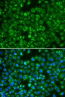 MTMR4 Antibody - Immunofluorescence analysis of A549 cells.