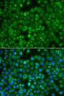 MTMR4 Antibody - Immunofluorescence analysis of A549 cells using MTMR4 Polyclonal Antibody.