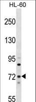 MTMR6 Antibody - MTMR6 Antibody western blot of HL-60 cell line lysates (35 ug/lane). The MTMR6 antibody detected the MTMR6 protein (arrow).