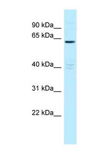 MTMR6 Antibody - MTMR6 antibody Western blot of H226 Cell lysate. Antibody concentration 1 ug/ml.  This image was taken for the unconjugated form of this product. Other forms have not been tested.