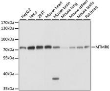 MTMR6 Antibody - Western blot analysis of extracts of various cell lines, using MTMR6 antibody at 1:1000 dilution. The secondary antibody used was an HRP Goat Anti-Rabbit IgG (H+L) at 1:10000 dilution. Lysates were loaded 25ug per lane and 3% nonfat dry milk in TBST was used for blocking. An ECL Kit was used for detection and the exposure time was 1s.