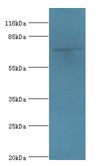 MTMR7 Antibody - Western blot. All lanes: Myotubularin-related protein 7 antibody at 2 ug/ml+mouse brain tissue. Secondary antibody: Goat polyclonal to rabbit at 1:10000 dilution. Predicted band size: 76 kDa. Observed band size: 76 kDa.  This image was taken for the unconjugated form of this product. Other forms have not been tested.