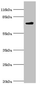 MTMR7 Antibody - Western blot All lanes: Myotubularin-related protein 7 antibody at 2µg/ml + Mouse brain tissue Secondary Goat polyclonal to rabbit IgG at 1/10000 dilution Predicted band size: 76, 65 kDa Observed band size: 76 kDa