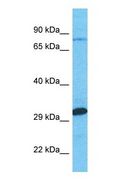 MTMR7 Antibody - Western blot of MTMR7 Antibody with human Jurkat Whole Cell lysate.  This image was taken for the unconjugated form of this product. Other forms have not been tested.