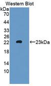 MTMR9 Antibody - Western blot of MTMR9 antibody.
