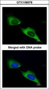 MTMR9 Antibody - Immunofluorescence of paraformaldehyde-fixed HeLa using MTMR9 antibody at 1:200 dilution.