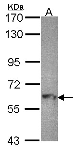 MTMR9 Antibody - Sample (30 ug of whole cell lysate). A: Hep G2 . 7.5% SDS PAGE. MTMR9 antibody. MTMR9 antibody diluted at 1:1000.