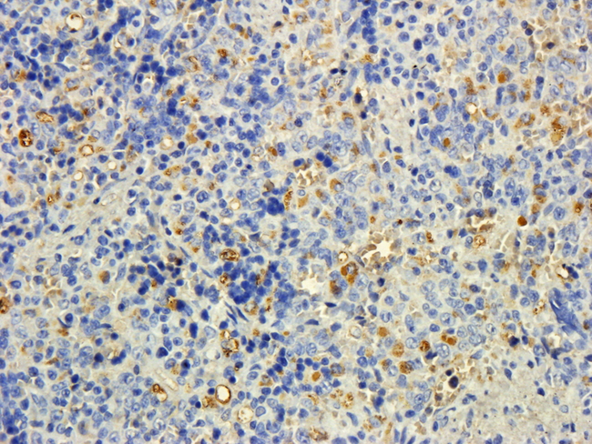 MTMR9 Antibody - Goat Anti-MTMR9 (C Terminus) Antibody (5ug/ml) staining of paraffin embedded Rat Spleen. Steamed antigen retrieval with citrate buffer pH 6, DAB-staining.