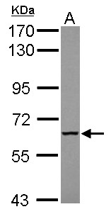 MTMR9 Antibody - Sample (30 ug of whole cell lysate) A: HeLa 7.5% SDS PAGE MTMR9 antibody diluted at 1:1000