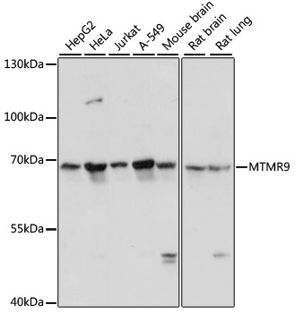 MTMR9 Antibody - Western blot analysis of extracts of various cell lines, using MTMR9 antibody at 1:3000 dilution. The secondary antibody used was an HRP Goat Anti-Rabbit IgG (H+L) at 1:10000 dilution. Lysates were loaded 25ug per lane and 3% nonfat dry milk in TBST was used for blocking. An ECL Kit was used for detection and the exposure time was 10s.