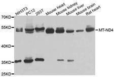 Mtnd4 Antibody - Western blot analysis of extracts of various cell lines, using MT-ND4 antibody at 1:1000 dilution. The secondary antibody used was an HRP Goat Anti-Rabbit IgG (H+L) at 1:10000 dilution. Lysates were loaded 25ug per lane and 3% nonfat dry milk in TBST was used for blocking. An ECL Kit was used for detection and the exposure time was 90s.