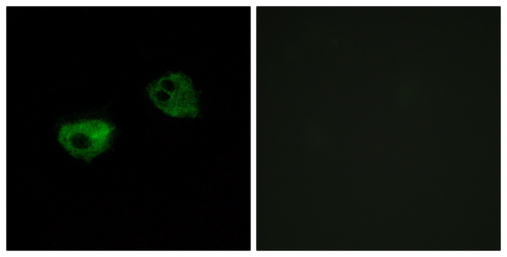 MTNR1A / Melatonin Receptor 1a Antibody - Immunofluorescence analysis of HepG2 cells, using MTR1A Antibody. The picture on the right is blocked with the synthesized peptide.