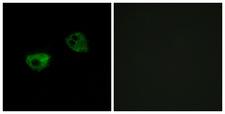 MTNR1A / Melatonin Receptor 1a Antibody - Immunofluorescence analysis of HepG2 cells, using MTR1A Antibody. The picture on the right is blocked with the synthesized peptide.