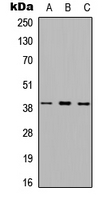 MTNR1A / Melatonin Receptor 1a Antibody - Western blot analysis of Melatonin Receptor 1a expression in A549 (A); NS-1 (B); PC12 (C) whole cell lysates.