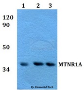 MTNR1A / Melatonin Receptor 1a Antibody - Western blot of MTNR1A antibody at 1:500 dilution. Lane 1: A549 whole cell lysate. Lane 2: sp2/0 whole cell lysate. Lane 3: PC12 whole cell lysate.