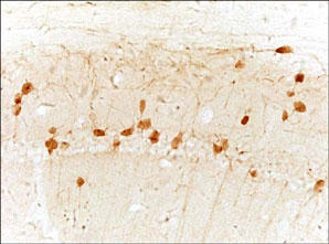 MTNR1A / Melatonin Receptor 1a Antibody - MTR-1A staining in rat brain. Paraffin-embedded rat brain is stained with MTR-1A Antibody used at 1:1000 dilution.