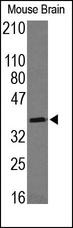 MTNR1A / Melatonin Receptor 1a Antibody - The MTR-1A Antibody is used in Western blot to detect MTR-1A in mouse brain lysates.