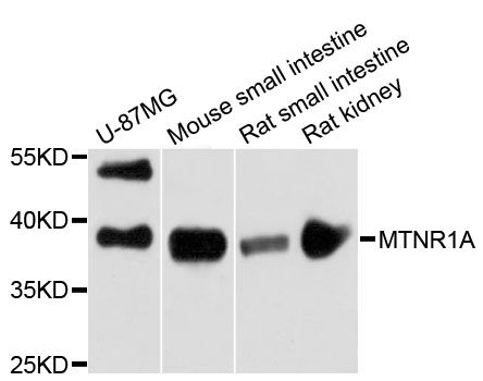 MTNR1A / Melatonin Receptor 1a Antibody - Western blot analysis of extracts of various cell lines, using MTNR1A antibody at 1:3000 dilution. The secondary antibody used was an HRP Goat Anti-Rabbit IgG (H+L) at 1:10000 dilution. Lysates were loaded 25ug per lane and 3% nonfat dry milk in TBST was used for blocking. An ECL Kit was used for detection and the exposure time was 90s.