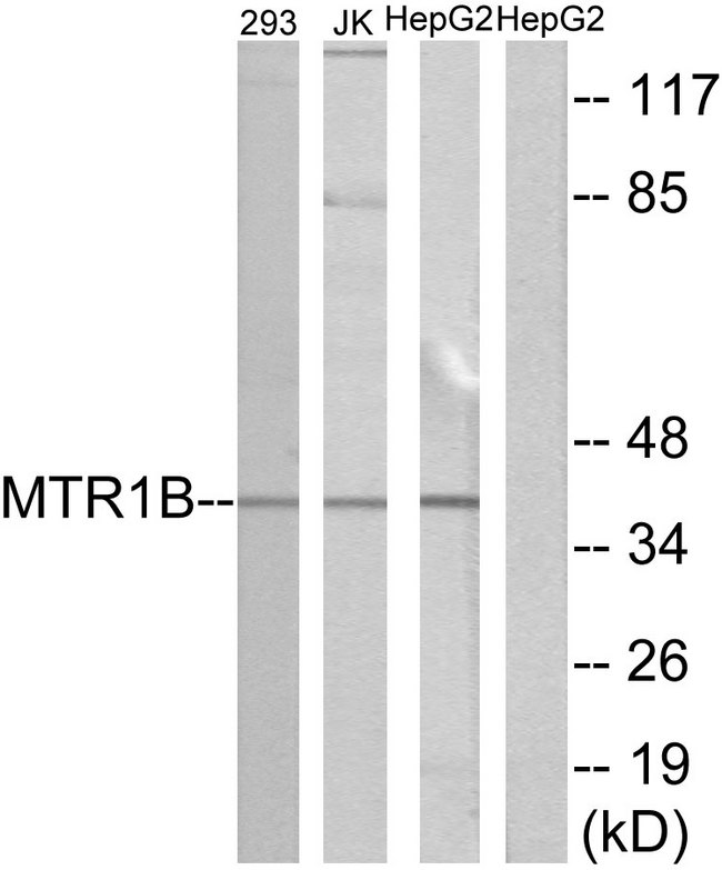 MTNR1B / MT2 Antibody - Western blot analysis of lysates from 293, Jurkat, and HepG2 cells, using MTR1B Antibody. The lane on the right is blocked with the synthesized peptide.