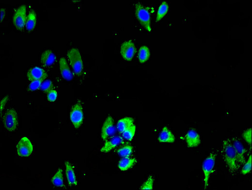 MTNR1B / MT2 Antibody - Immunofluorescent analysis of HepG2 cells using MTNR1B Antibody at a dilution of 1:100 and Alexa Fluor 488-congugated AffiniPure Goat Anti-Rabbit IgG(H+L)