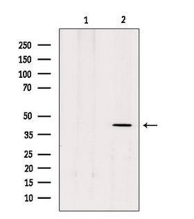 MTNR1B / MT2 Antibody - Western blot analysis of extracts of rat brain tissue using MTR1B antibody. Lane 1 was treated with the antigen-specific peptide.