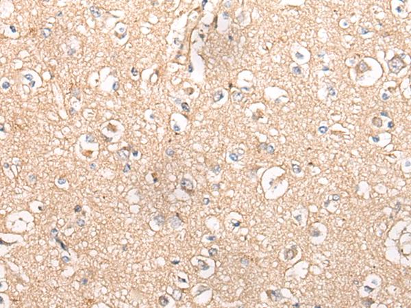 MTNR1B / MT2 Antibody - Immunohistochemistry of paraffin-embedded Human brain tissue  using MTNR1B Polyclonal Antibody at dilution of 1:55(×200)