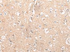 MTNR1B / MT2 Antibody - Immunohistochemistry of paraffin-embedded Human brain tissue  using MTNR1B Polyclonal Antibody at dilution of 1:55(×200)