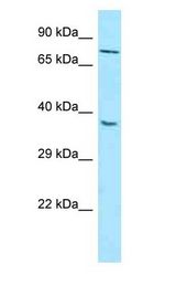 MTNR1B / MT2 Antibody - MTNR1B / MT2 antibody Western Blot of HepG2.  This image was taken for the unconjugated form of this product. Other forms have not been tested.