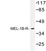 MTNR1B / MT2 Antibody - Western blot of MEL-1B-R (V39) pAb in extracts from 293/Jurkat/HepG2 cells.