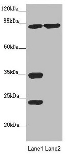 MTO1 Antibody - Western blot All Lanes: MTO1 antibody at 4.11 ug/ml Lane 1: Rat heart tissue Lane 2: Jurkat whole cell lysate Secondary Goat polyclonal to rabbit IgG at 1/10000 dilution Predicted band size: 80,67,35,78,73,82 kDa Observed band size: 80,34,24 kDa