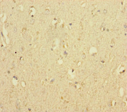 MTO1 Antibody - Immunohistochemistry of paraffin-embedded human brain tissue at dilution of 1:100