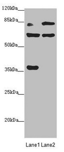 MTO1 Antibody - Western blot All Lanes: MTO1 antibody at 2.25 ug/ml Lane 1: Rat heart tissue Lane 2: Jurkat whole cell lysate Secondary Goat polyclonal to rabbit IgG at 1/10000 dilution Predicted band size: 80,67,35,78,73,82 kDa Observed band size: 80,65,36 kDa