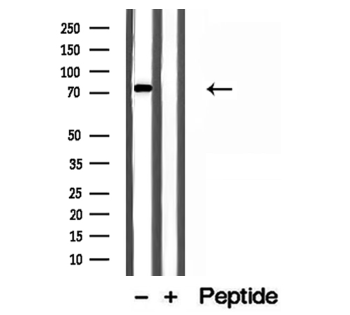 MTO1 Antibody - Western blot analysis of extracts of Jurkat cells using MTO1 antibody.