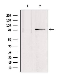 MTO1 Antibody - Western blot analysis of extracts of mouse brain tissue using MTO1 antibody. Lane 1 was treated with the blocking peptide.