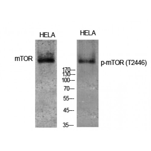 MTOR Antibody - Western blot of Phospho-mTOR (T2446) antibody