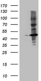 MTOR Antibody - Human recombinant protein fragment corresponding to amino acids 1766-2144 of human MTOR (NP_004949) produced in E.coli.