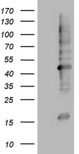 MTOR Antibody - Human recombinant protein fragment corresponding to amino acids 1766-2144 of human MTOR (NP_004949) produced in E.coli.