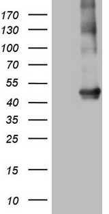 MTOR Antibody - Human recombinant protein fragment corresponding to amino acids 1766-2144 of human MTOR(NP_004949) produced in E.coli.